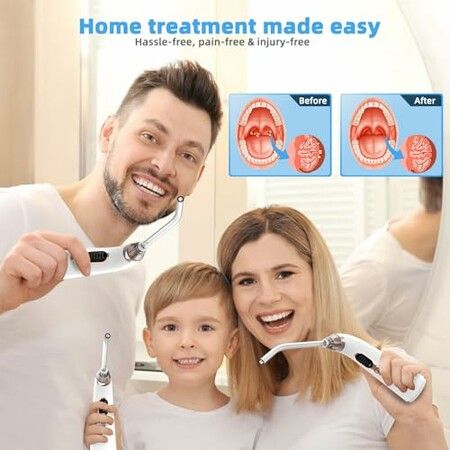 Tonsil Stone Remover Electronic Vacuum Stone Removal Kit, 5 Modes Instant Suction Tool, Easy to Use, Fresh Breath, Mouth Cleaning Oral Care