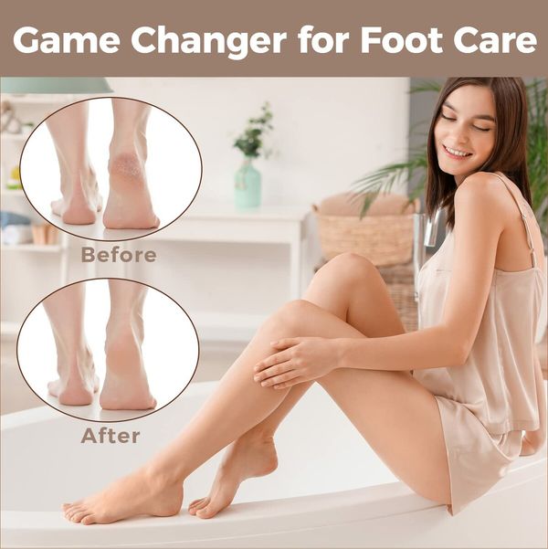 Foot File Foot Scrubber Pedicure,Callus Remover for Feet Professional Grater Rasp Foot Scraper Corns Callous Removers Cracked Dead Skin Remover for Dry and Wet Feet (Brown)