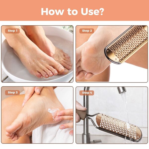 Foot File Foot Scrubber Pedicure,Callus Remover for Feet Professional Grater Rasp Foot Scraper Corns Callous Removers Cracked Dead Skin Remover for Dry and Wet Feet (Rose Golden)