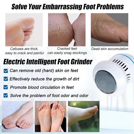 Electric Foot Grinder, Vacuum Absorption Electric Grinder, 8 Grinding Heads, 2 Speeds, Portable and Handheld for Care Anytime