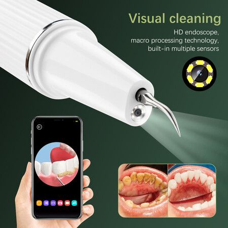 Ultrasonic Tooth Cleaner Visual Electric Dental Scaler Calculus Remover Teeth Whitening Plaque Stain Cleaner