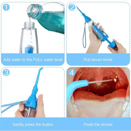 Water Dental Irrigator for Teeth Oral Irrigator Water Teeth Cleaner, Non-Electric Selection, Portable, Cordless Oral Irrigator, Manual Air Pressure, Simple Operation