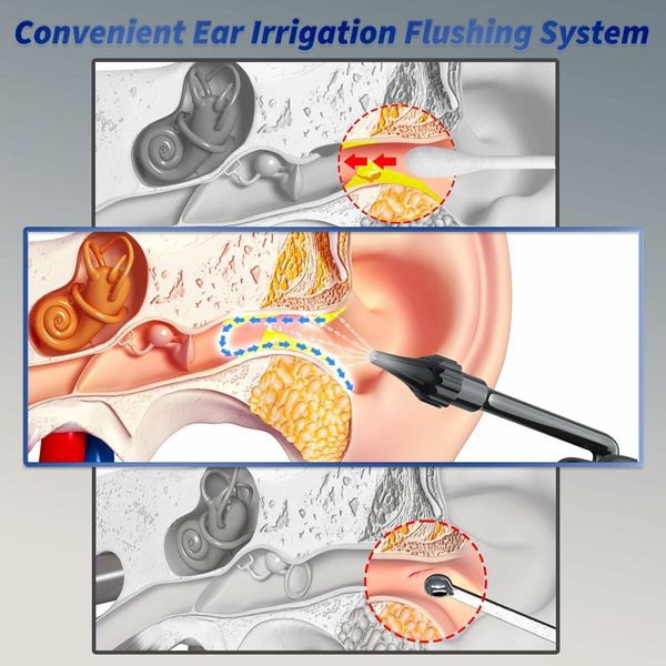 Ear Wax Removal - Electric Ear Cleaner - Water Powered Ear Cleaner with 4 Water Pressure Cleaning Modes - Safe and Safe Ear Wax Removal Tool