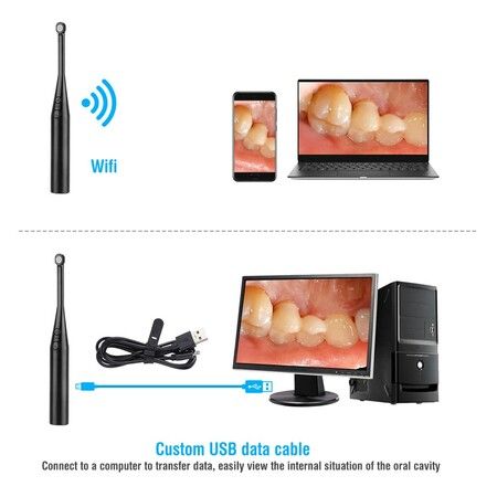 Dental Oral Camera For Pc iOS Android,Wireless Intraoral Endoscope Dental Camera 3 in 1 USB Dental Care Endoscope Dental Magnifier