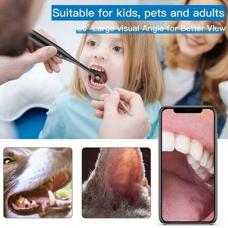 Dental Oral Camera For Pc iOS Android,Wireless Intraoral Endoscope Dental Camera 3 in 1 USB Dental Care Endoscope Dental Magnifier