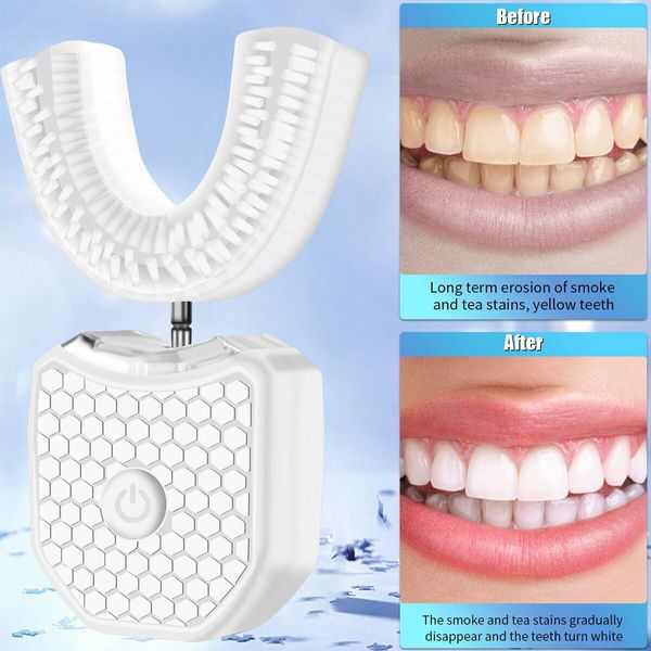 Electric Ultrasonic U-Shaped Toothbrush Bristles 360 Degree Automatic Fully Automatic Intelligent Cleaning Sonic (White)