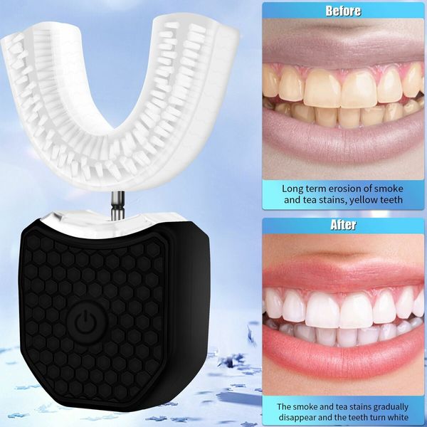 Electric Ultrasonic U-Shaped Toothbrush Bristles 360 Degree Automatic Fully Automatic Intelligent Cleaning Sonic (Black)