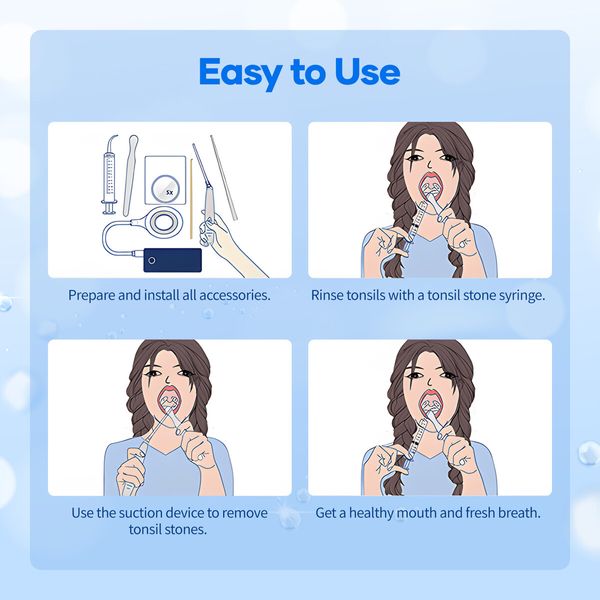 Tonsil Stone Removal Kit Remover Electronic Rock Extractor Oral Care Extraction Tool Cleaner Mouth Vacuum Cleaning 5 Suction Modes