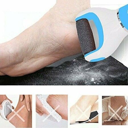 Professional Electronic Foot File: Effortlessly Remove Calluses and Reveal Smooth Feet