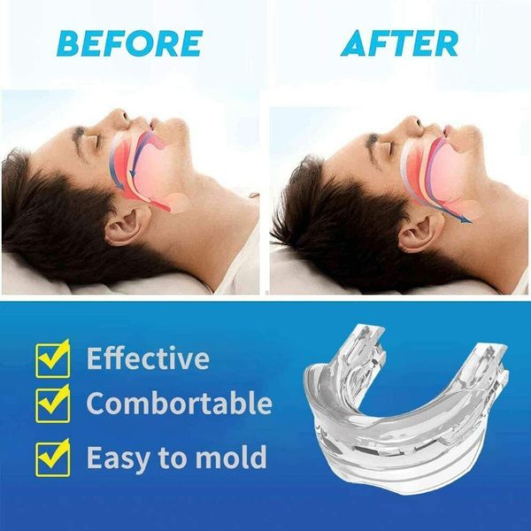 1 pack Anti-Snoring Mouthpiece: Snore Stopper for Men and Women