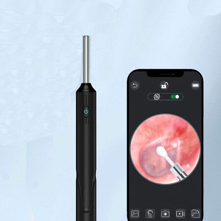 Wireless Ear Wax Cleaner with Camera: Connect to Phone via WiFi for Crystal Clear Images