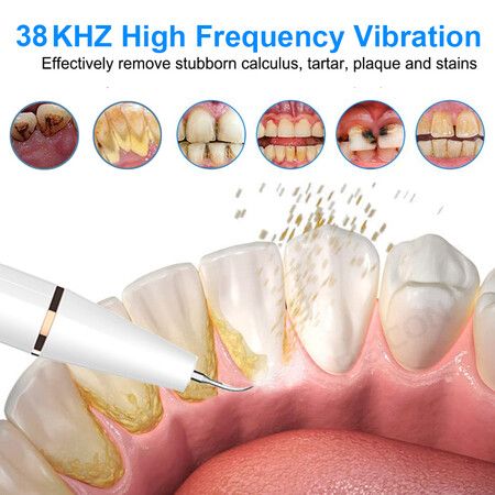 Professional Ultrasonic Dental Scaler - Effortlessly Remove Tartar and Stains