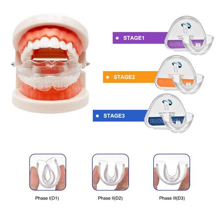 3-Stage Dental Orthodontic Braces/Teeth Retainer/Bruxism Mouth Guard-Correct Misalignment,Prevent Bruxism