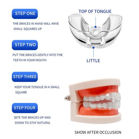 3-Stage Dental Orthodontic Braces/Teeth Retainer/Bruxism Mouth Guard-Correct Misalignment,Prevent Bruxism