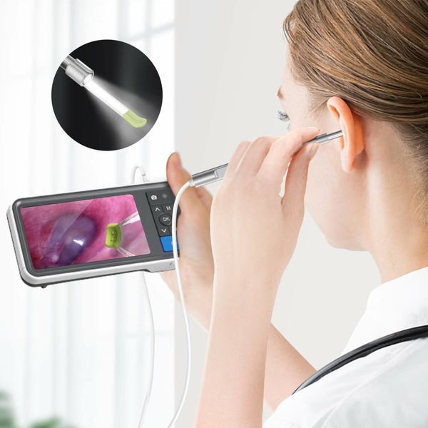 Advanced Digital Otoscope with High-Definition Screen,3.9mm Ear Camera,6 LED Lights,Ear Wax Removal Tool,Rechargeable Battery for Comprehensive ear inspection