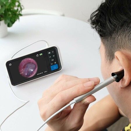 Advanced Digital Otoscope with High-Definition Screen,3.9mm Ear Camera,6 LED Lights,Ear Wax Removal Tool,Rechargeable Battery for Comprehensive ear inspection