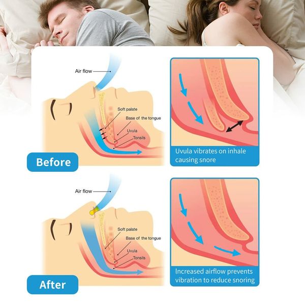 4PCS Immediately anti-snoring Snore Stopper, Silicone Nose Clip, Breathing Aid with Magnets