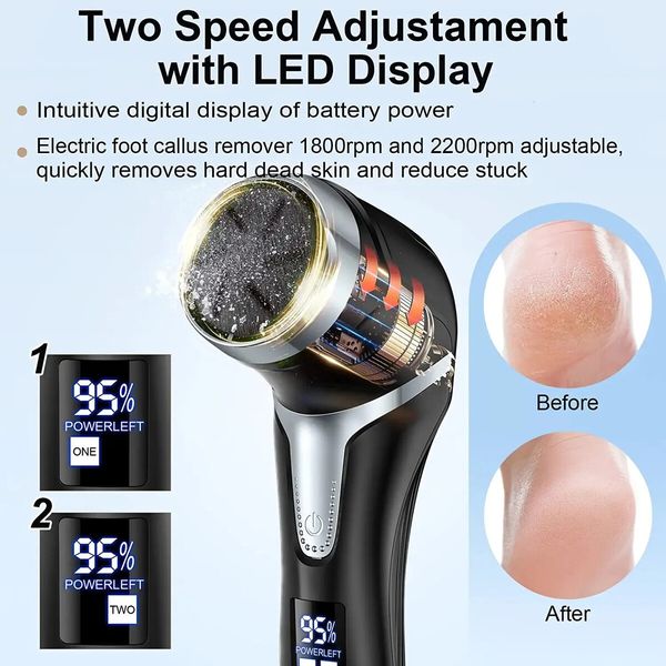 Rechargeable Electric Callus Remover with 3 Rollers and 2 Speeds for Effective Callus and Dead Skin Removal