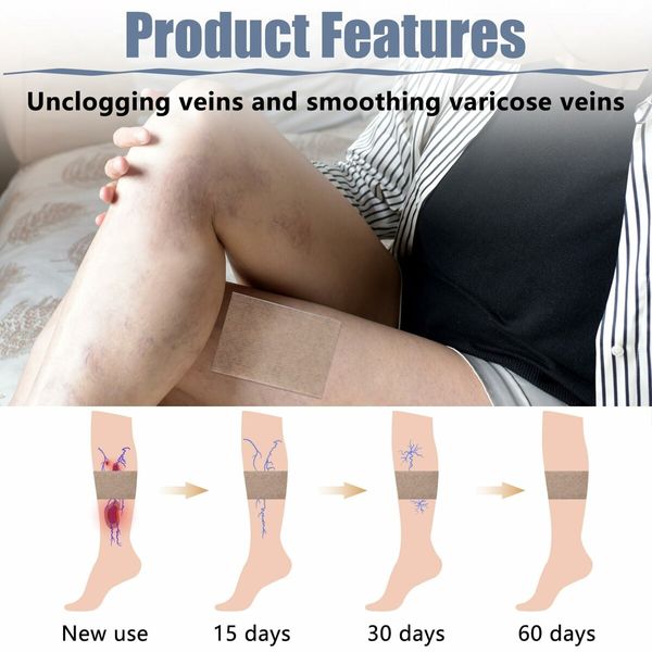 36PCS Varicose Veins Patch   Relief Treatment for Legs, Spider Varicose Vein, Strengthen Capillary Health and Improve Blood Circulation