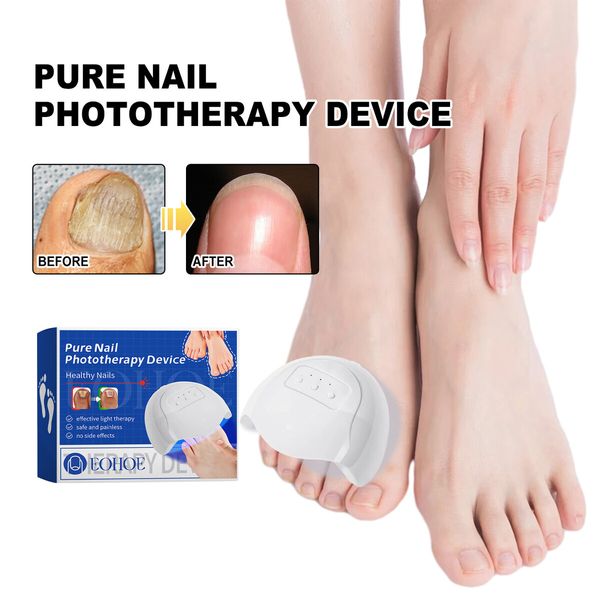 Nail Device Nail Fungus Cleaning Device Nail Fungus for Damaged Discolored Thick Toenails  Fingernails