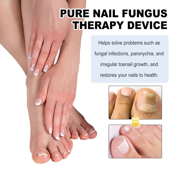 Nail Device Nail Fungus Cleaning Device Nail Fungus for Damaged Discolored Thick Toenails  Fingernails