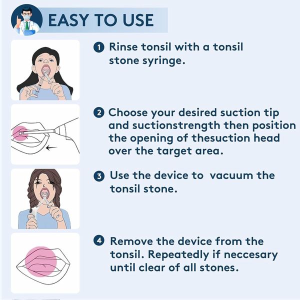 Electronic Vacuum Tonsil Stone Remover with Built in LED Light with 3 Levels Suction, Instant Suction, White