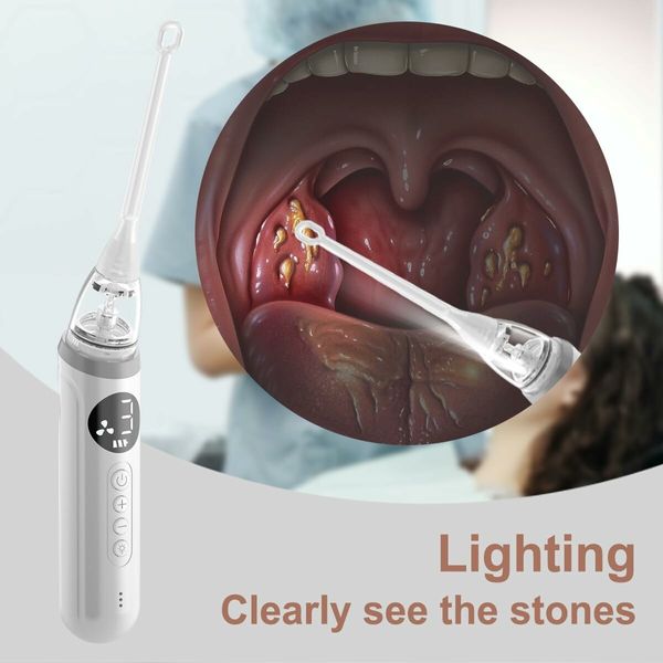 Tonsil Stone Remover,Electronic Vacuum Tonsil Stone Remover,with Built in LED Light and 3 Suction Mode,Oral Irrigator, 5 Shadowless Nozzles